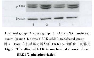 FAK ڻеѹյ EK1/2 ữеͼ